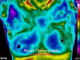 Breast Thermography vs Mammogram–Which is Better?